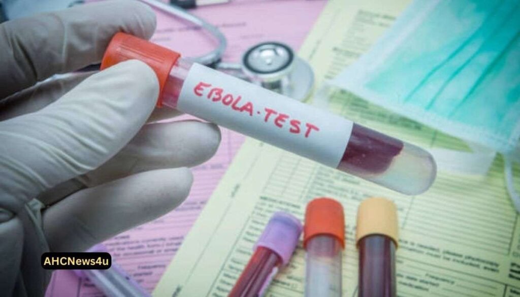The first instance of tularemia found in Wheat Edge occupant, Jefferson Province wellbeing authorities say